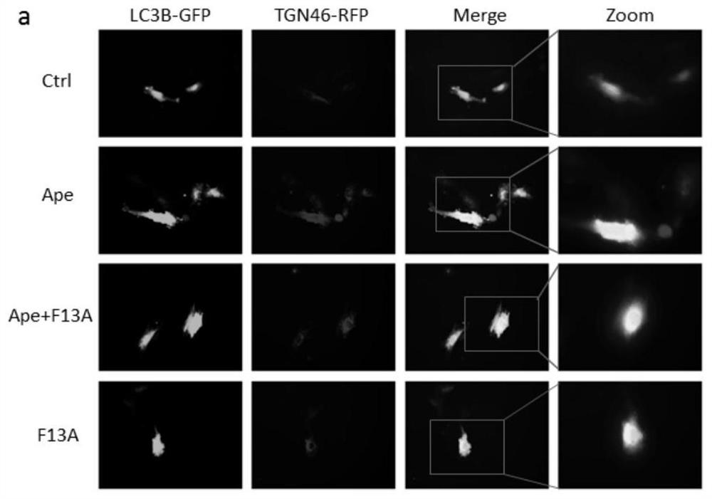 Application of siRNA-golph3 in the preparation of drugs for preventing or treating cardiomyocyte hypertrophy