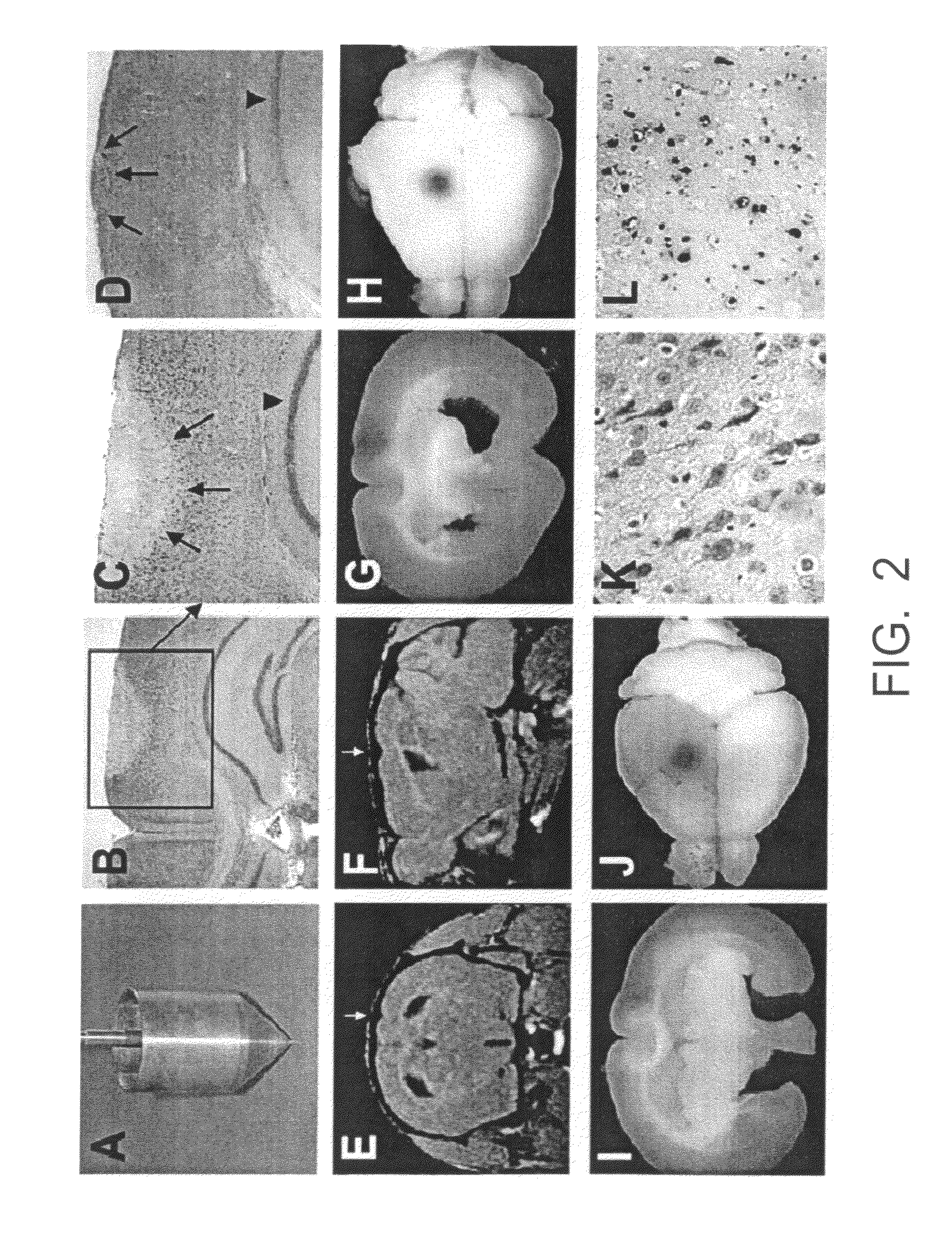 Use of erythropoietin and substances increasing and/or prolonging the activation and/or stimulation of erythropoietin receptors for treating and/or preventing schizophrenia and related psychoses