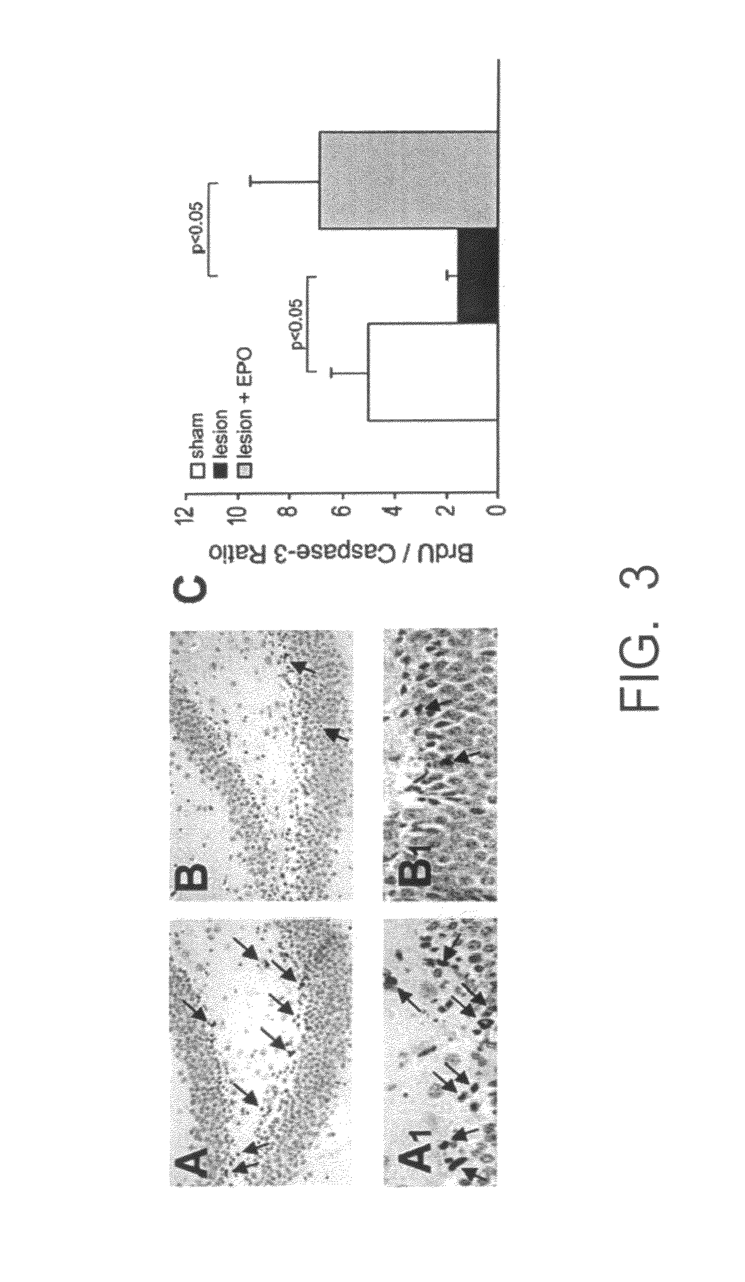 Use of erythropoietin and substances increasing and/or prolonging the activation and/or stimulation of erythropoietin receptors for treating and/or preventing schizophrenia and related psychoses