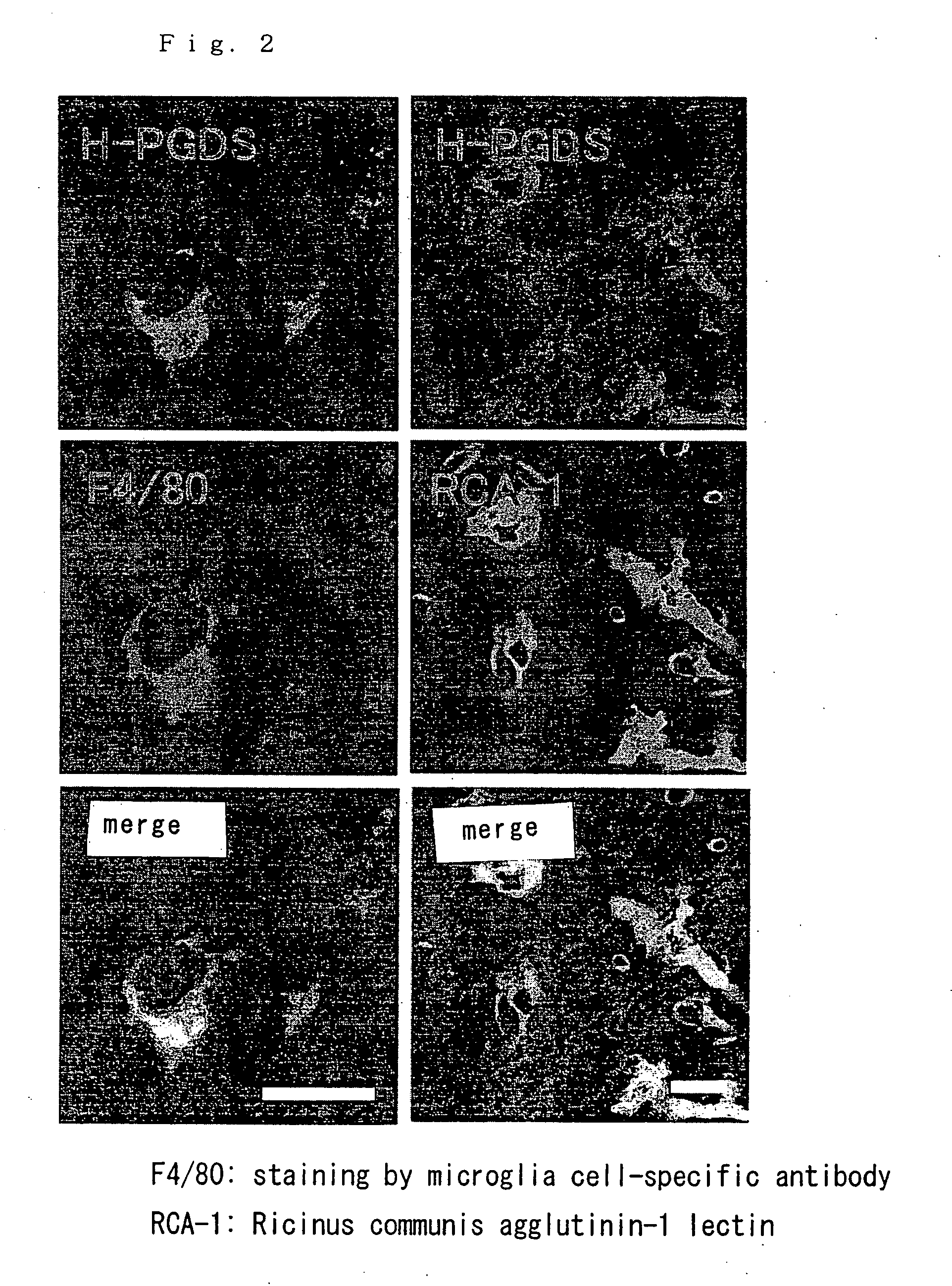 Drugs for improving the prognosis of brain injury and a method of screening the same