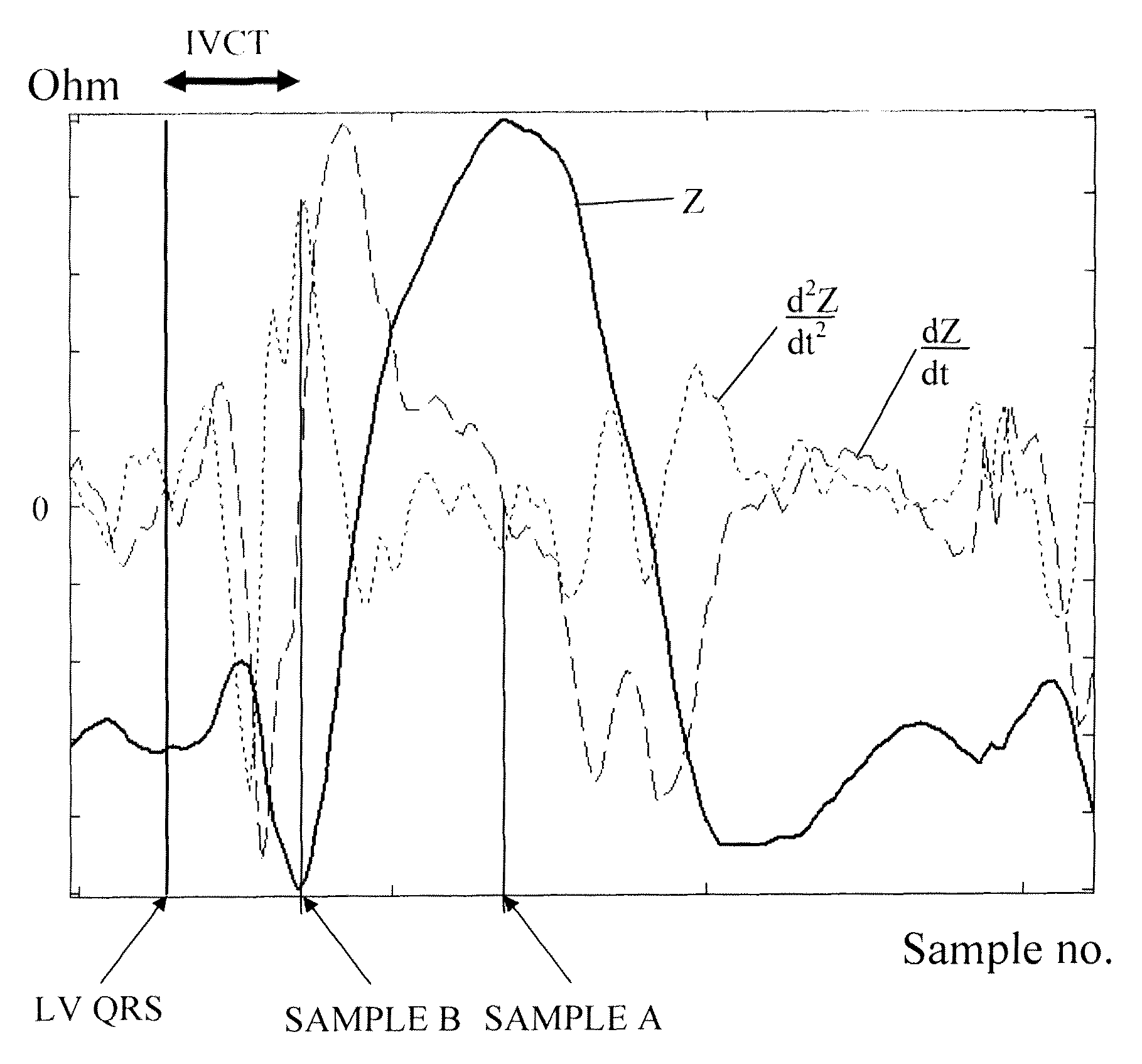 Method and device for estimating a myocardial performance parameter