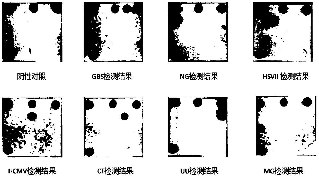 Nucleic acid group, kit and detection method for intrauterine microbiological detection of pregnant and lying-in women