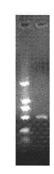 Achromobacter xylosoxidans MG1 strain and application thereof