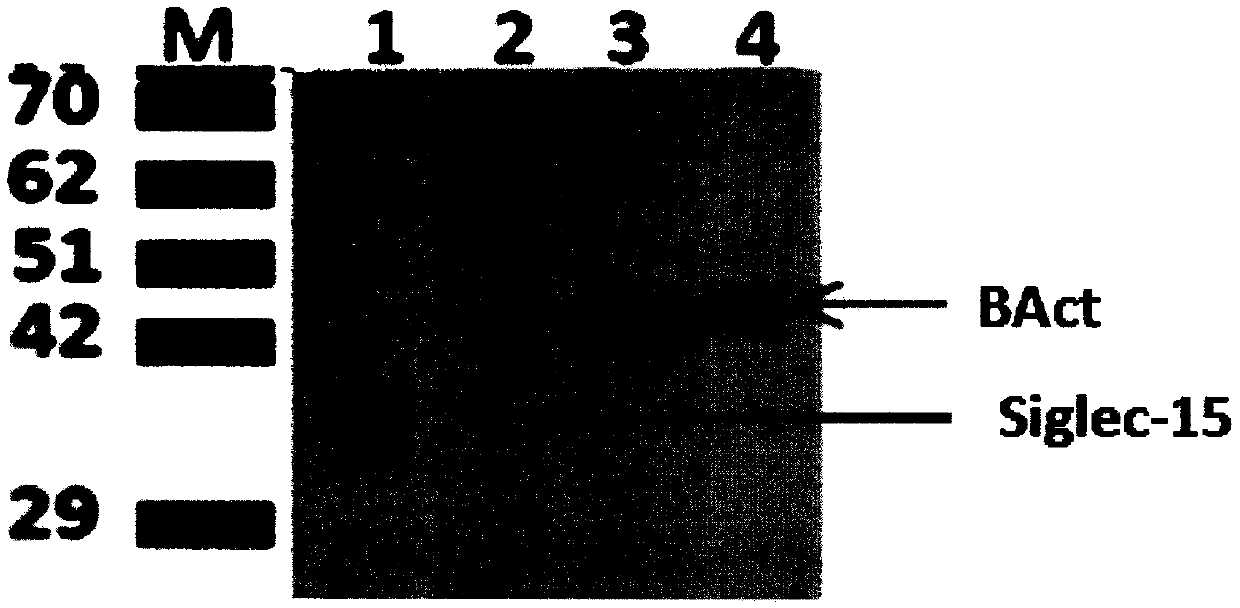 Preparation and application of mouse monoclonal antibody against human Siglec-15 protein