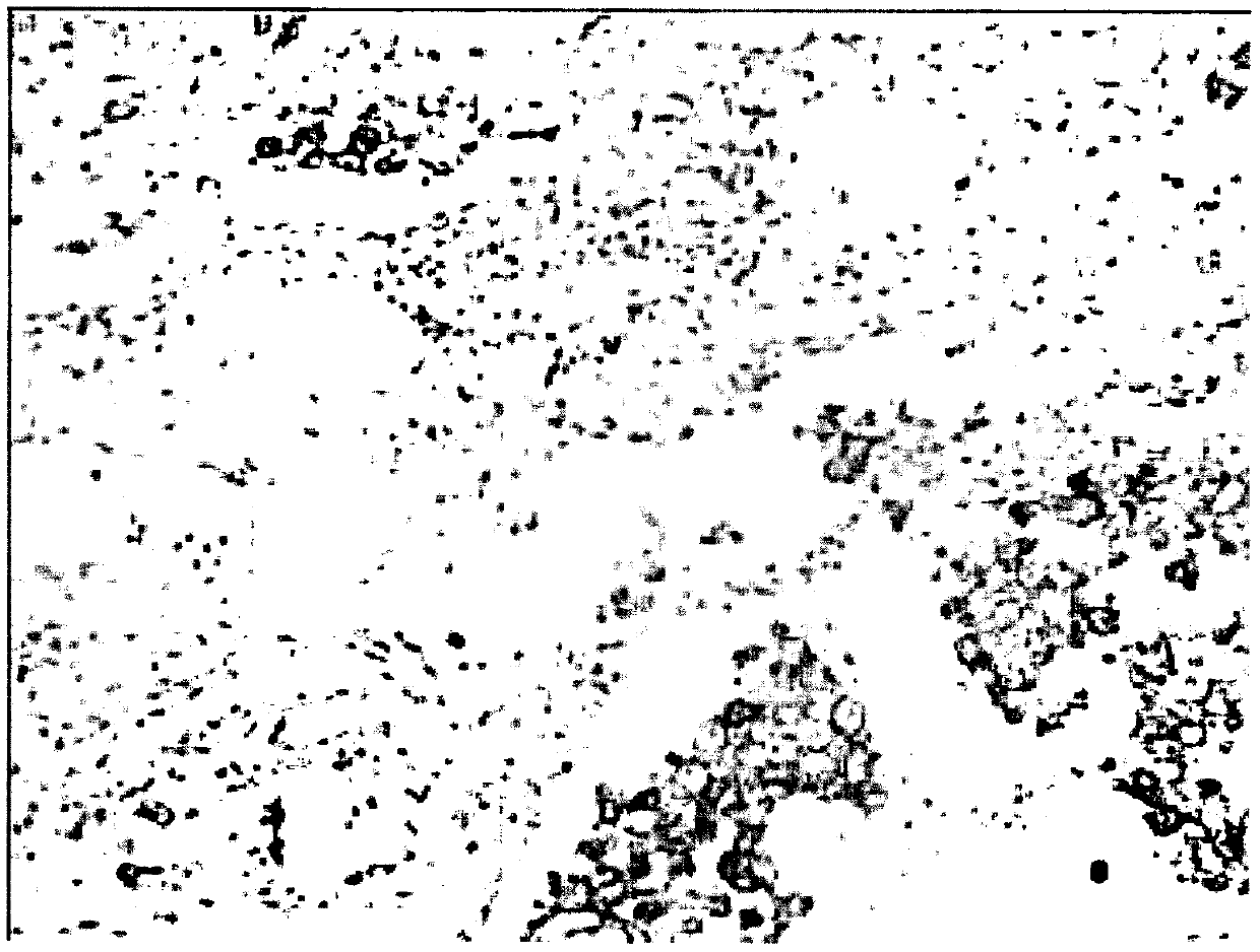 Preparation and application of mouse monoclonal antibody against human Siglec-15 protein