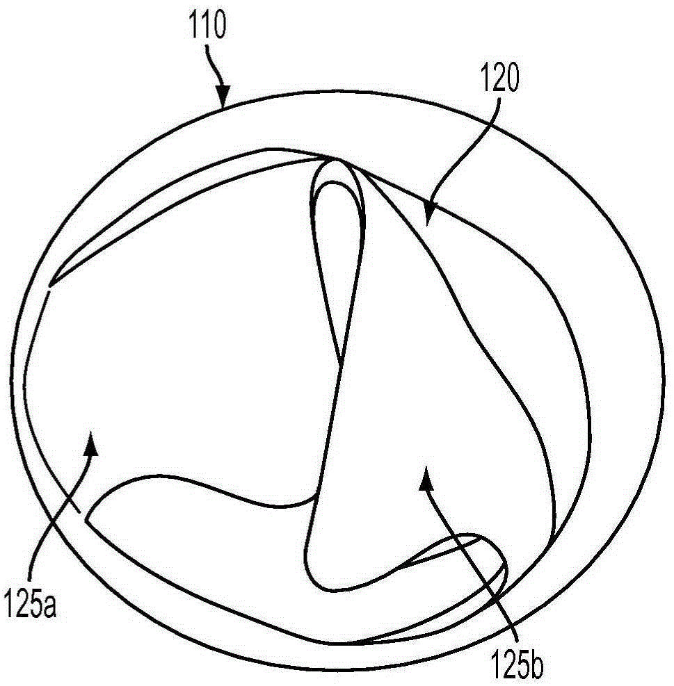 Expandable implantable conduit