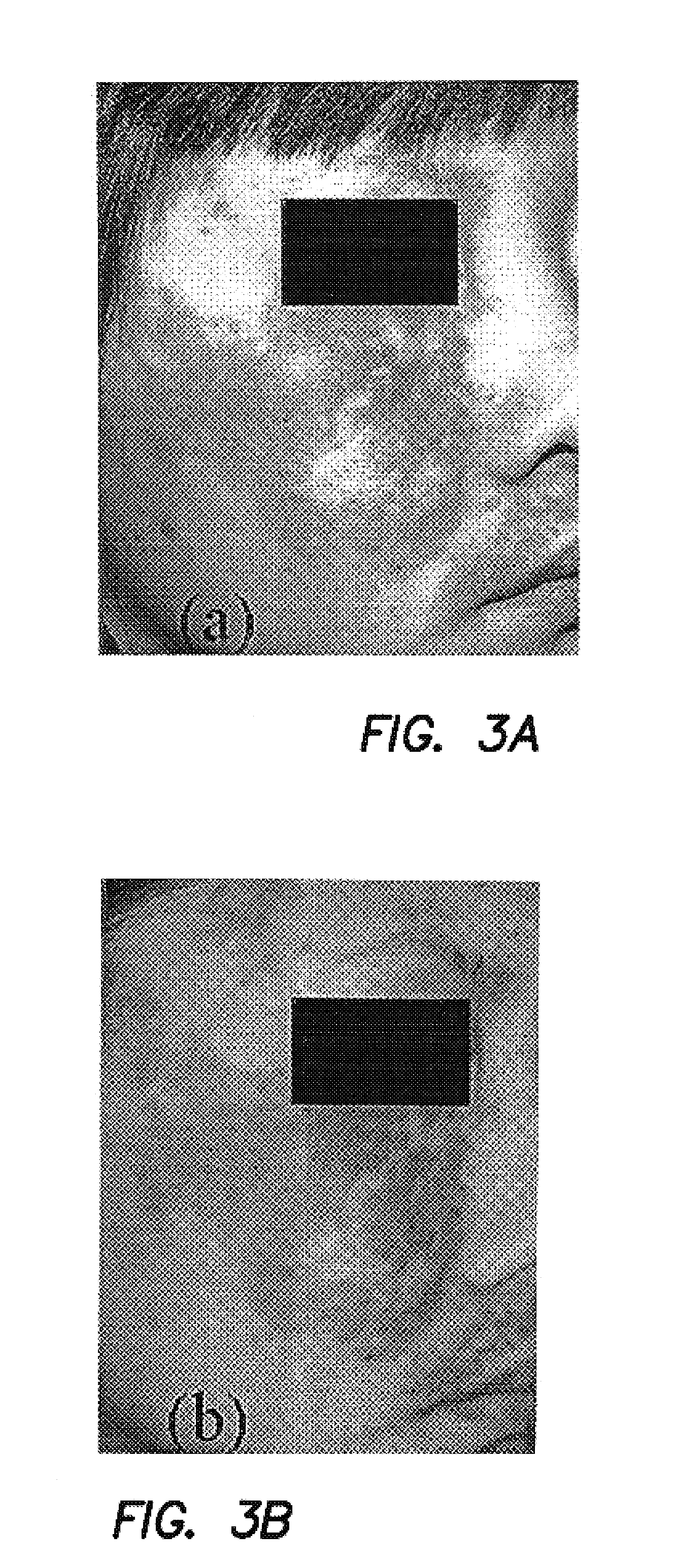 Method and apparatus for characterization of chromophore content and distribution in skin using cross-polarized diffuse reflectance imaging