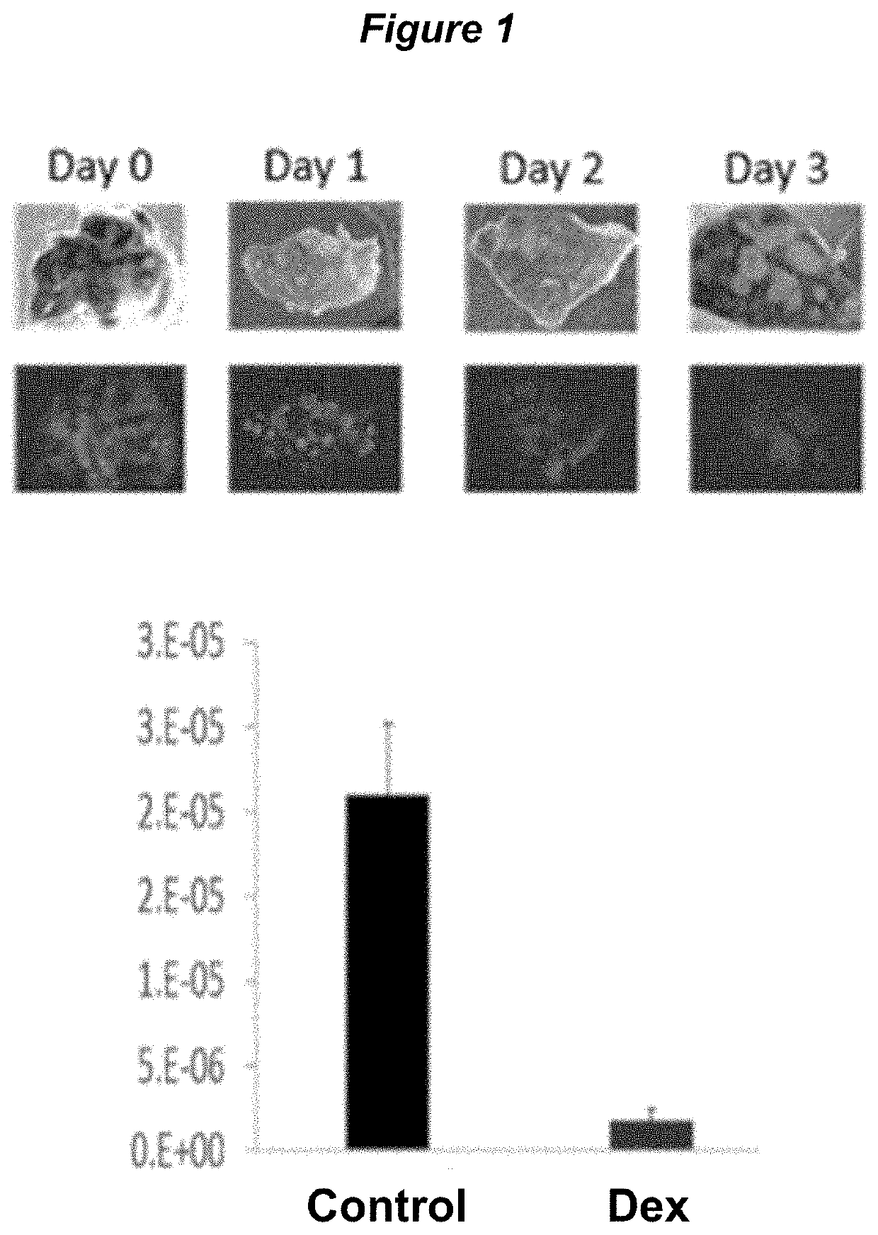 Immunoablative therapies