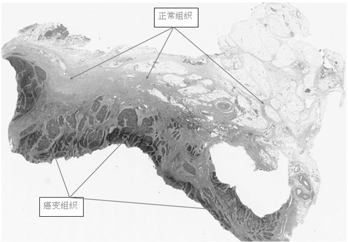 Method for identifying source of tumor tissue based on Identifiler system