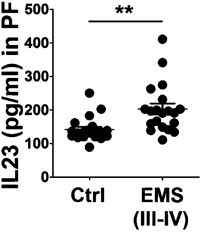 Application of interleukin 23 neutralizing antibody in preparation of drug for endometriosis