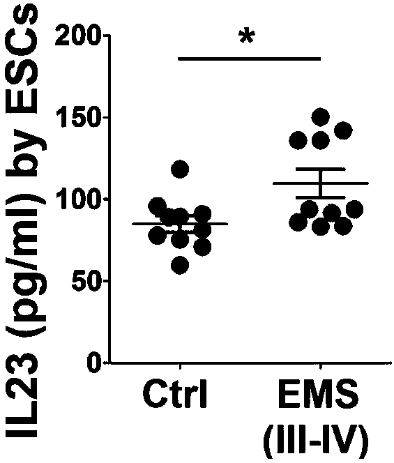 Application of interleukin 23 neutralizing antibody in preparation of drug for endometriosis