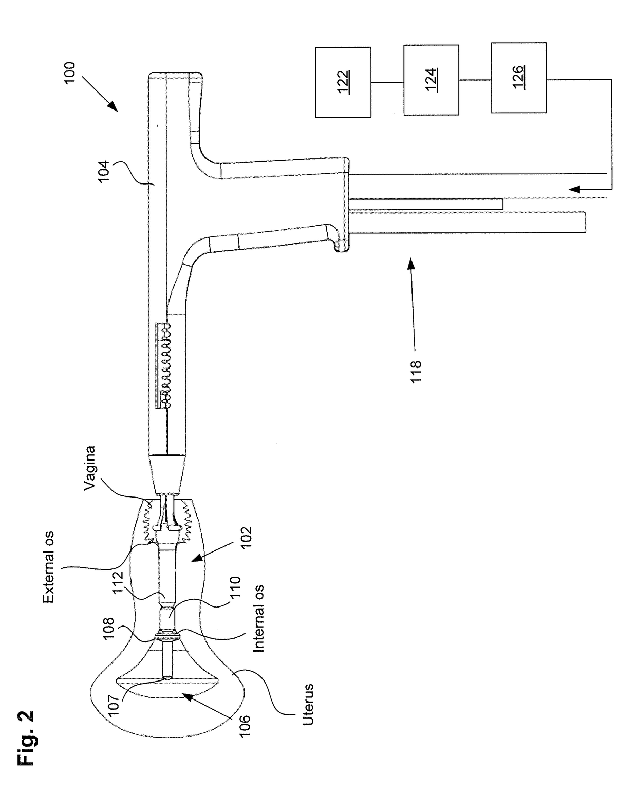 Methods and apparatus for determining the integrity of a bodily cavity