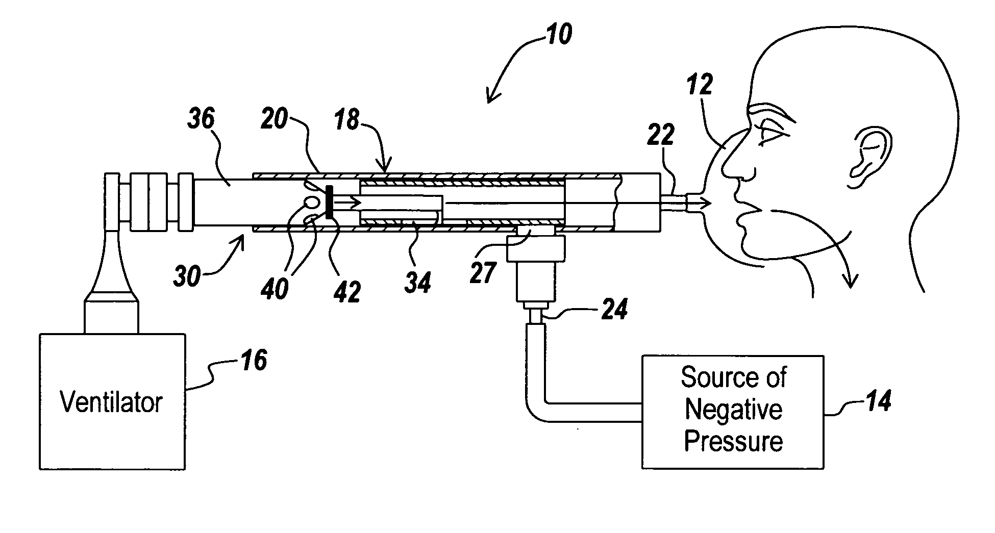 Inexsufflator