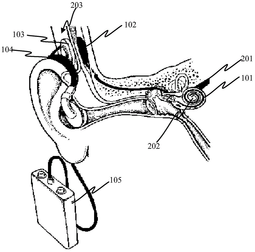 Low battery prompting method and prompting device for cochlear implant