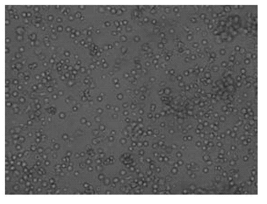 Method for preparing CD3+CD56+cells through high-killing K562cells from perinatal placental blood