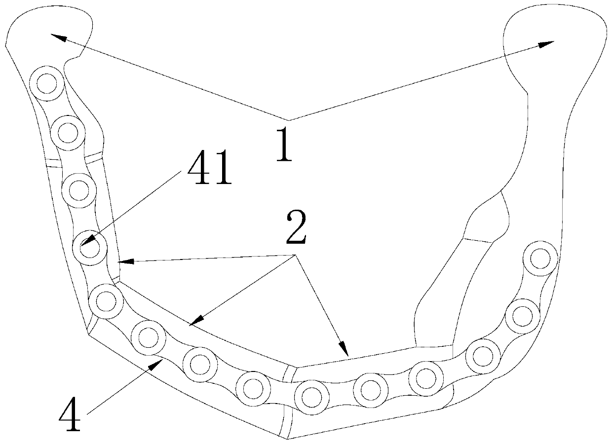 Cuttable Fibula reconstruction jaw defect model and manufacturing method and application thereof