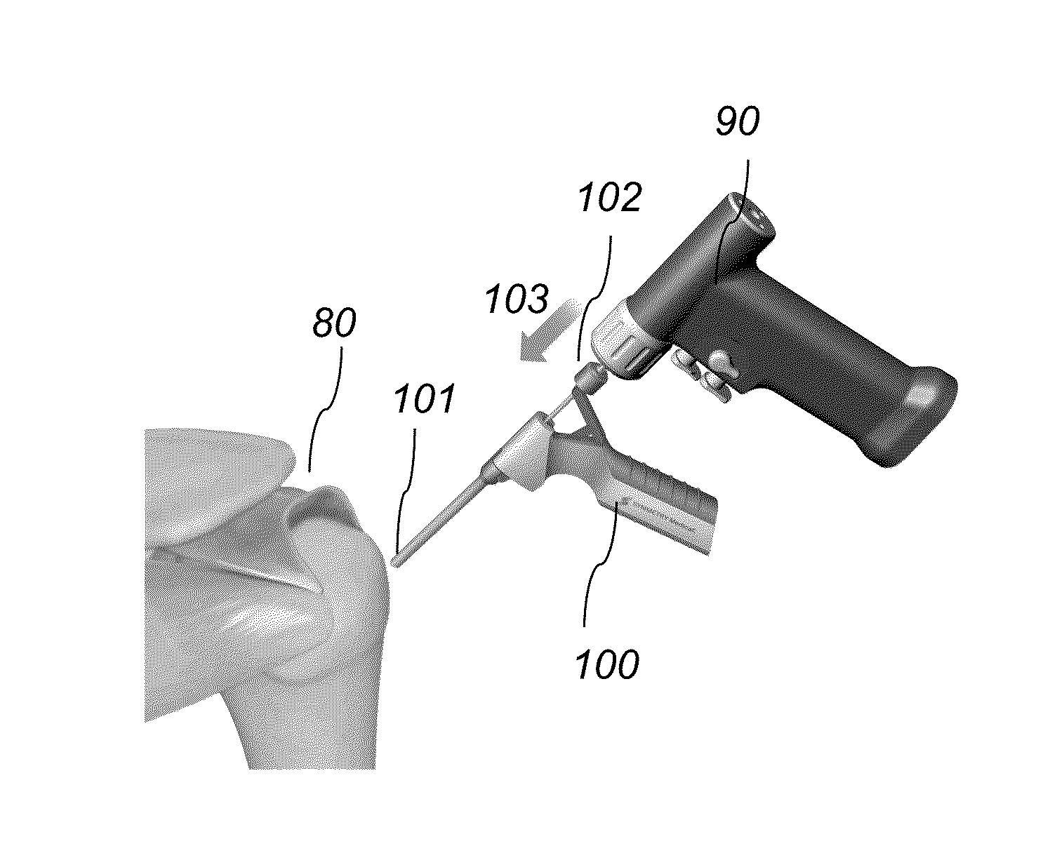 System and method for forming a curved tunnel in bone