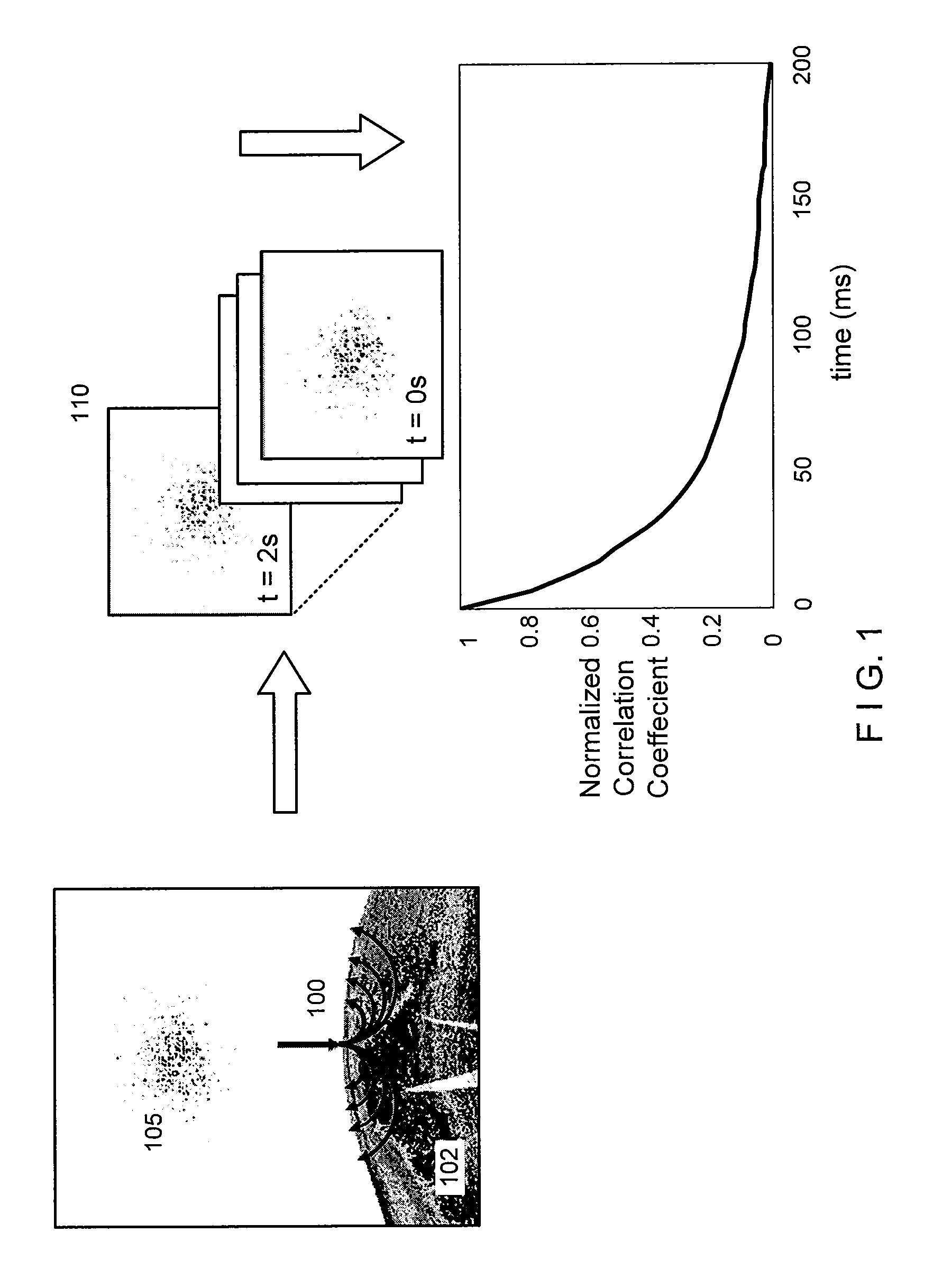 System and method providing intracoronary laser speckle imaging for the detection of vulnerable plaque