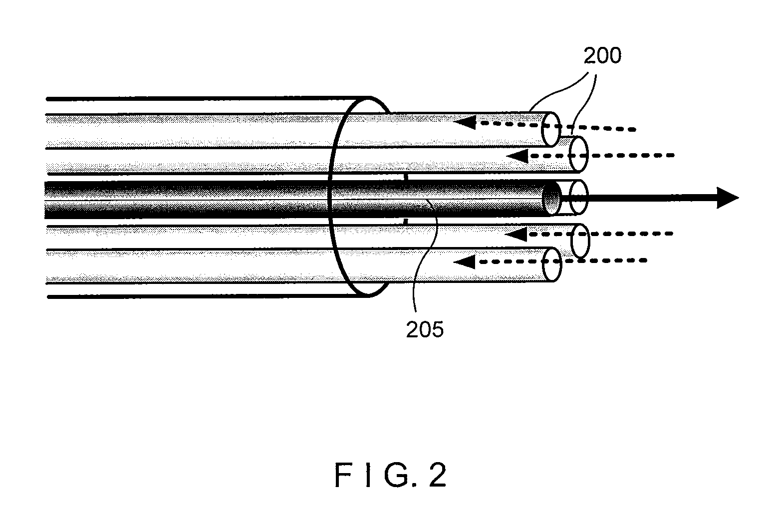 System and method providing intracoronary laser speckle imaging for the detection of vulnerable plaque