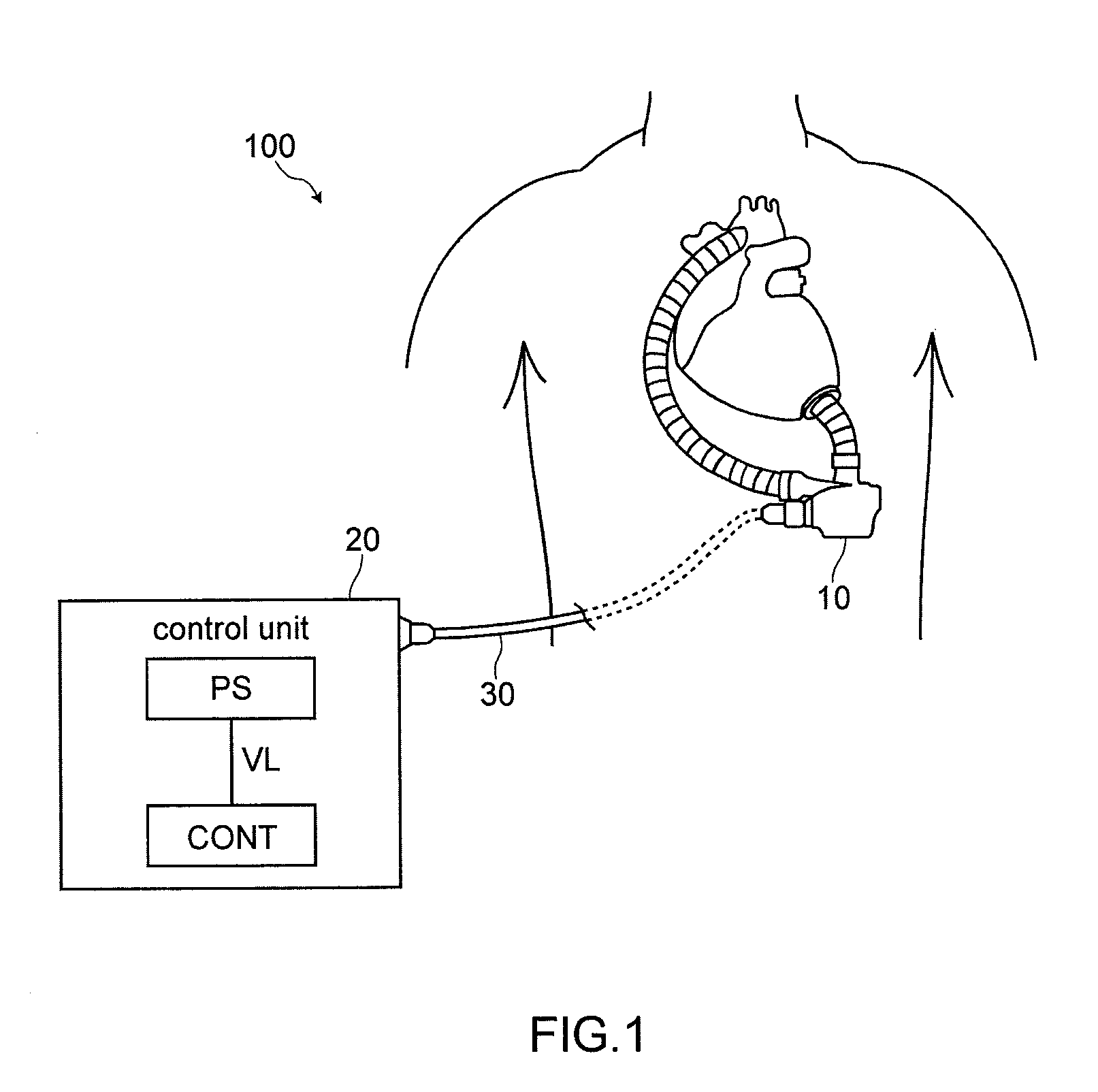 Auxiliary artificial heart pump drive device and auxiliary artifical heart system