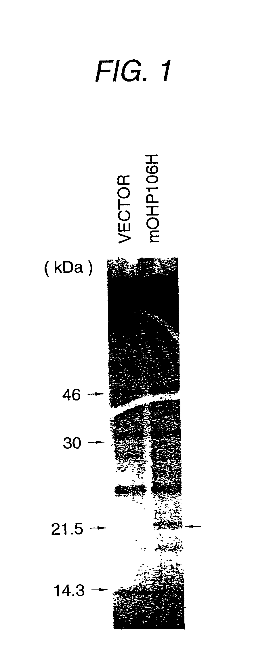 Polypeptide, cDNA encoding the same, and use of them