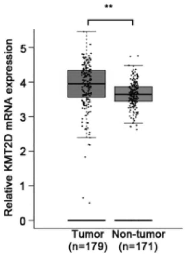 Application of KMT2D in preparation of antitumor drugs