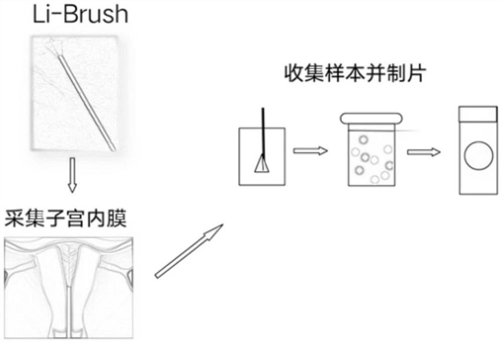 Endometrial cancer cell detection method, system and equipment and storage medium