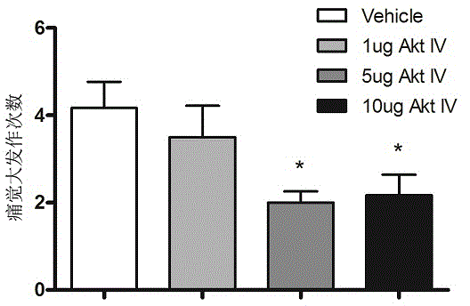 Novel use of protein kinase B inhibitor