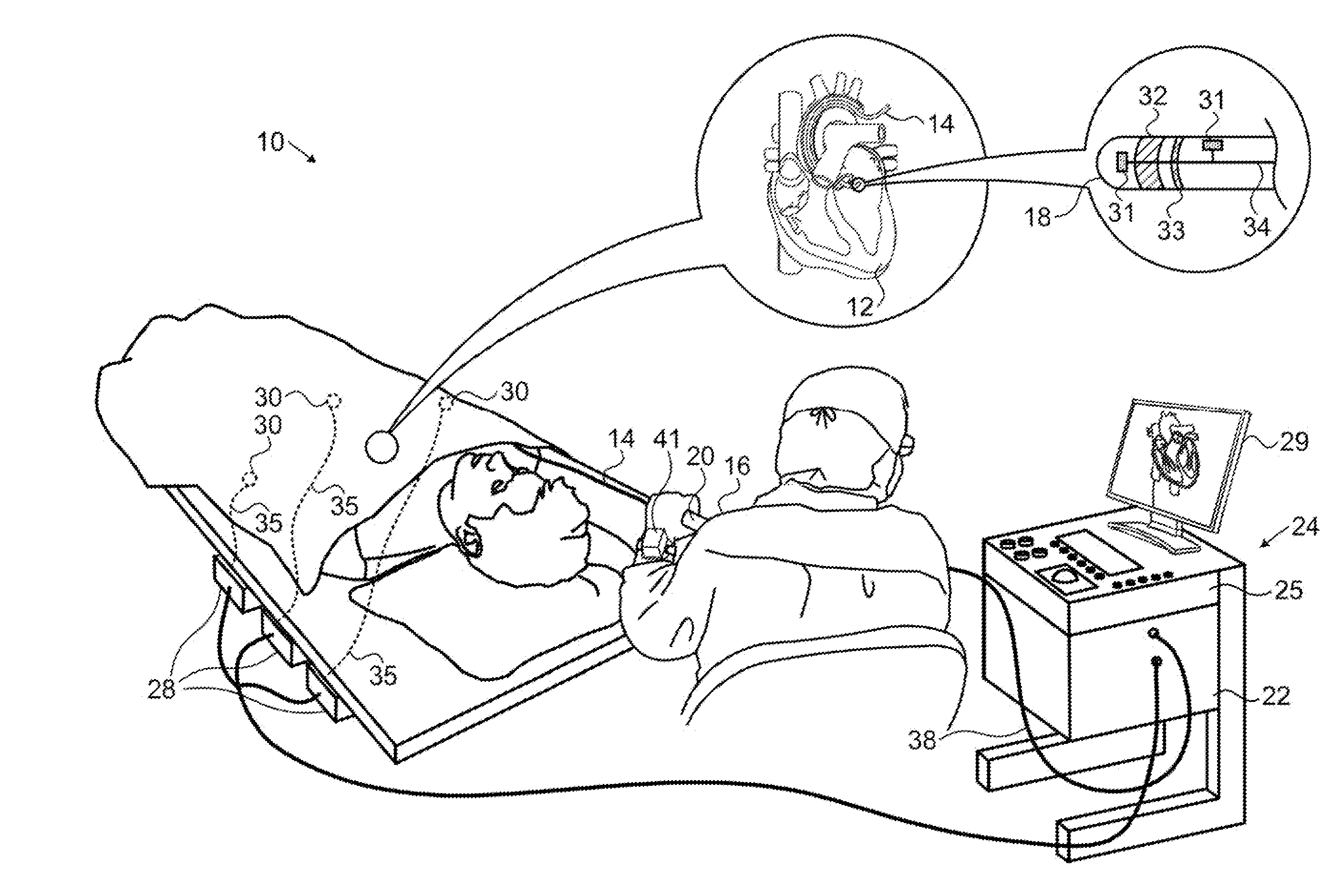 Force feedback device and method for catheters