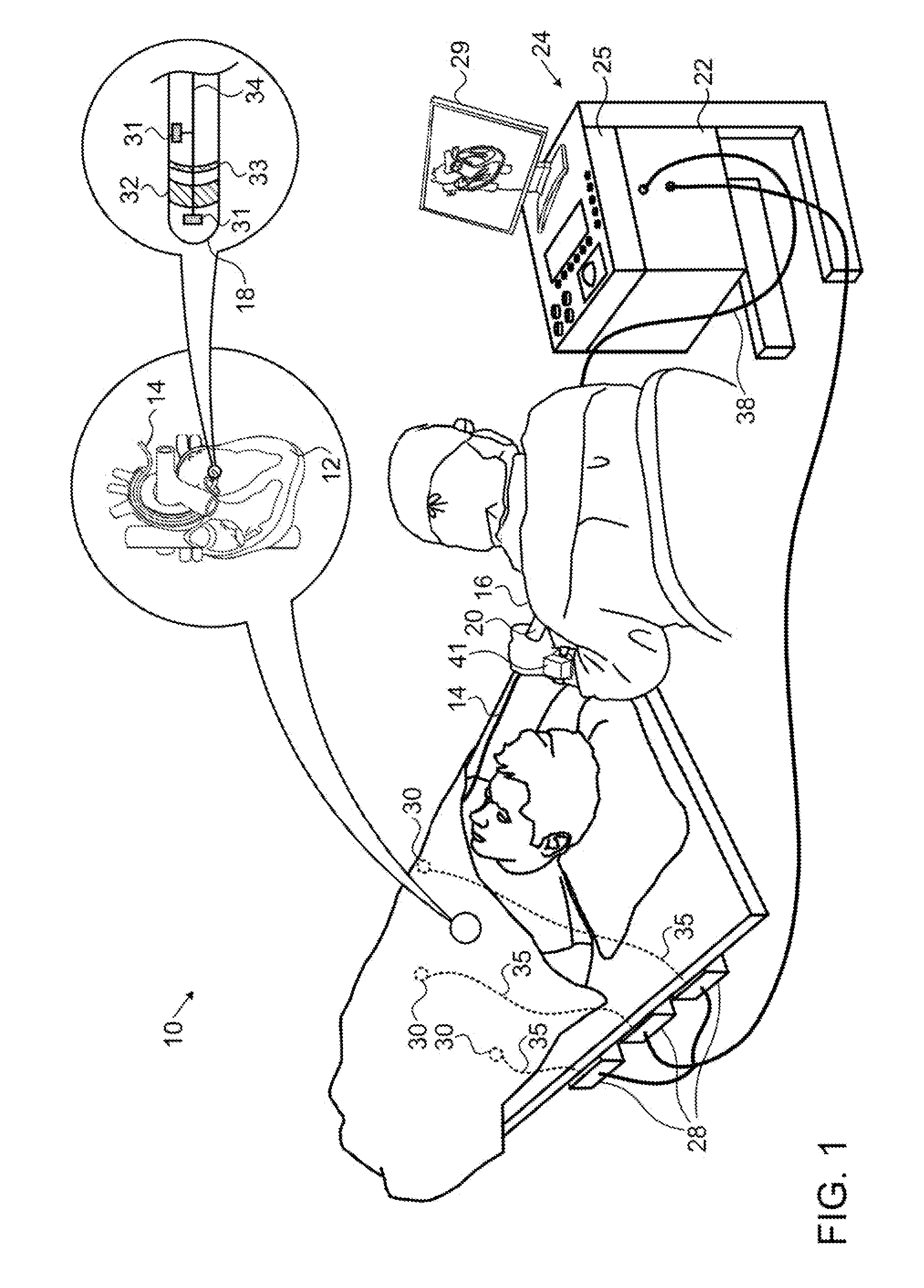 Force feedback device and method for catheters