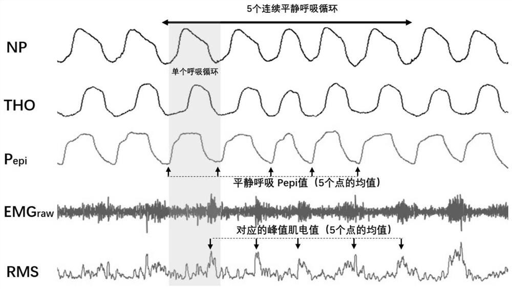 Non-invasive intraoral genioglossus myoelectric activity assessment method and system