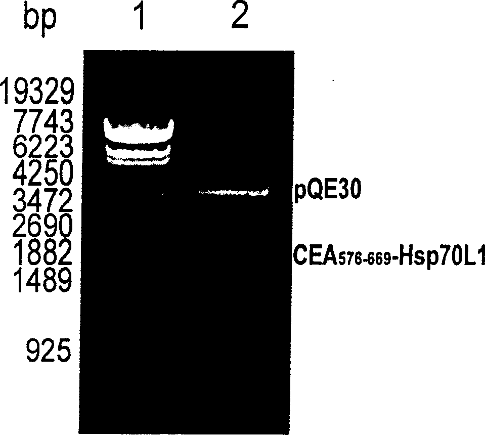 Preparation and application of vaccine for curing tumor in positive carcino-embryonic antigen