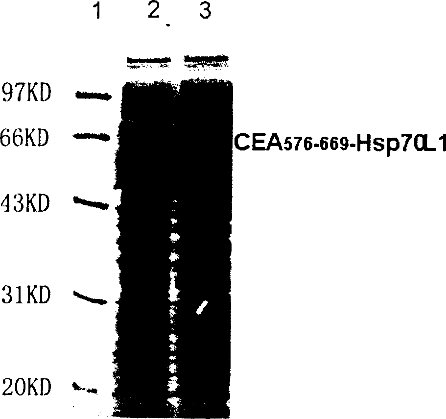 Preparation and application of vaccine for curing tumor in positive carcino-embryonic antigen