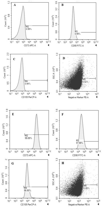 Stem cell exosome microneedle patch for removing freckles and wrinkles and preparation method of stem cell exosome microneedle patch