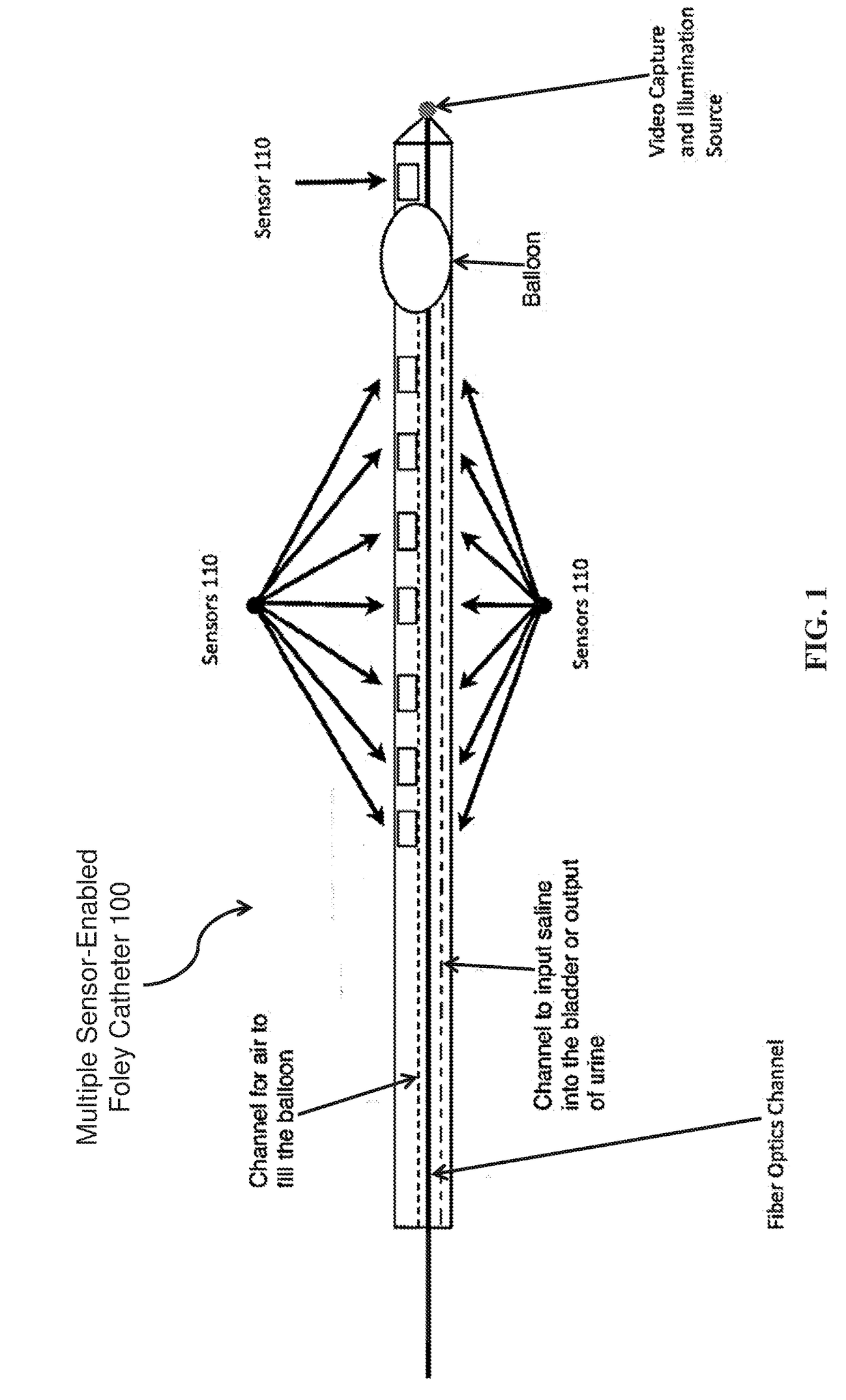 Treatment of urinary incontinence