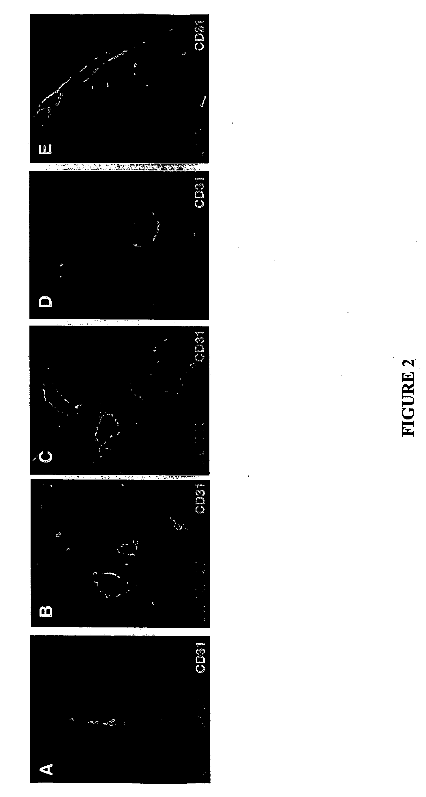 Molecules that selectively home to vasculature of pre-malignant dysplastic lesions or malignancies