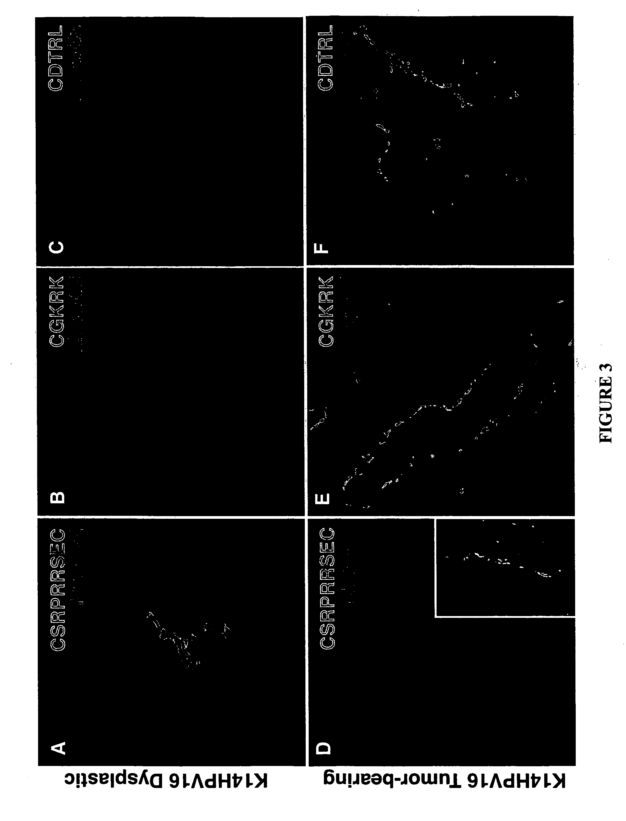 Molecules that selectively home to vasculature of pre-malignant dysplastic lesions or malignancies