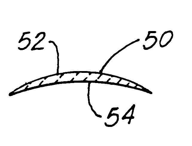 Corneal implant and method of manufacture