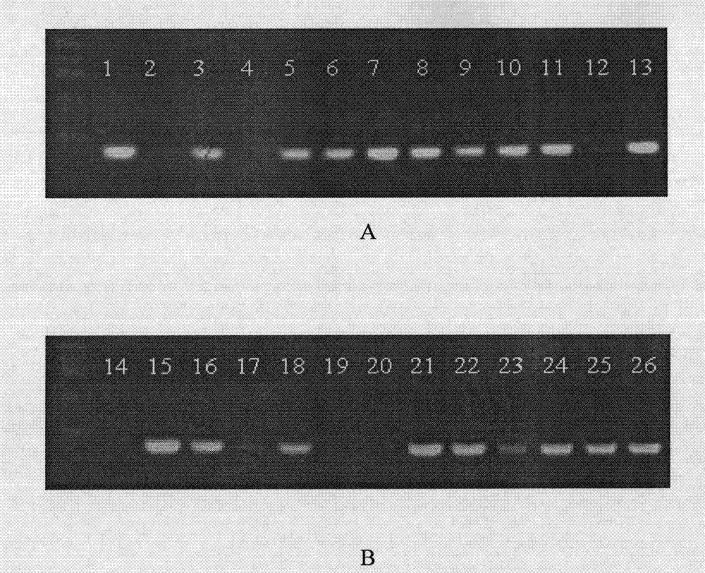 Soybean folate synthesis key enzymes GTPCHI and their genes and use