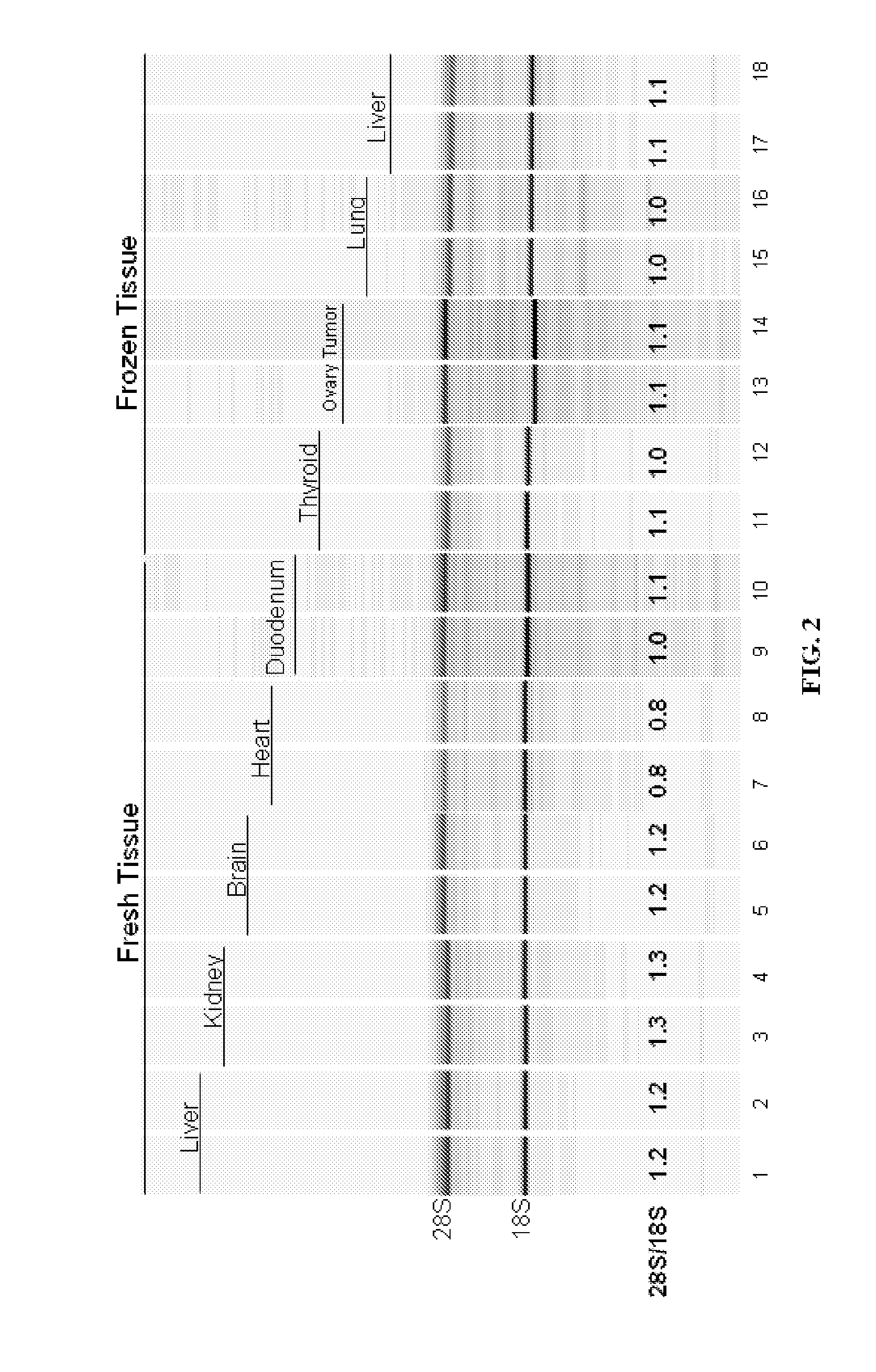 Enzymatic digestion of tissue