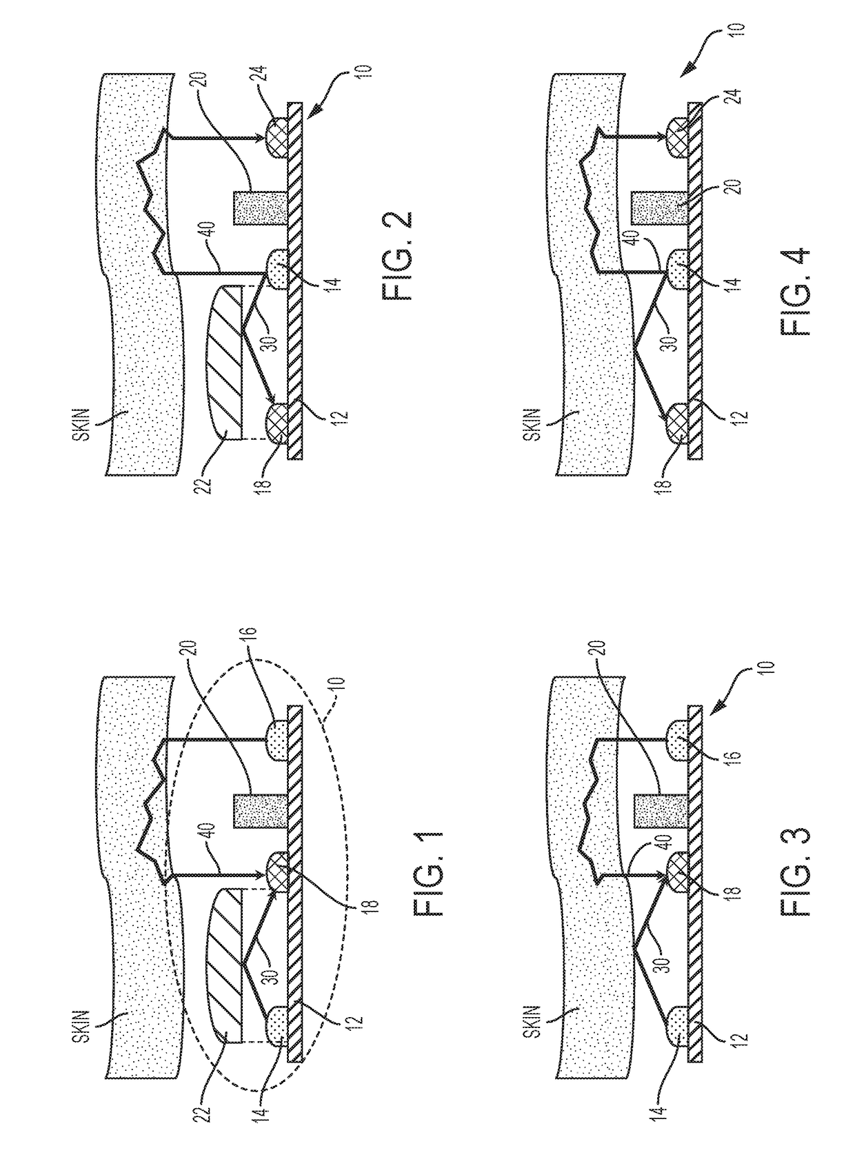 Methods and apparatus for detecting motion via optomechanics