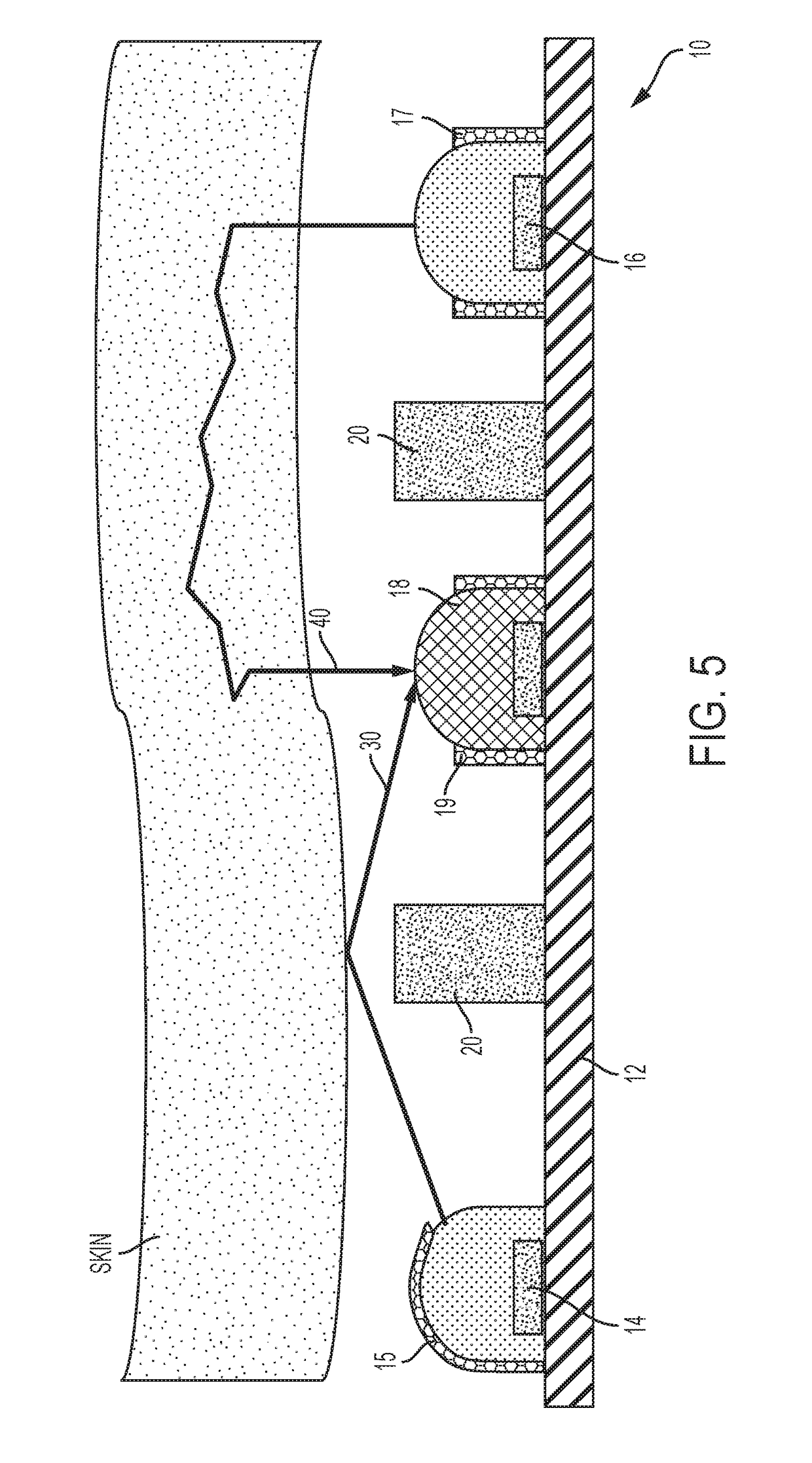 Methods and apparatus for detecting motion via optomechanics