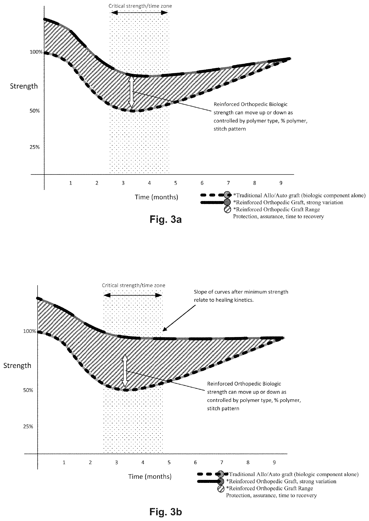 Reinforced Orthopedic devices