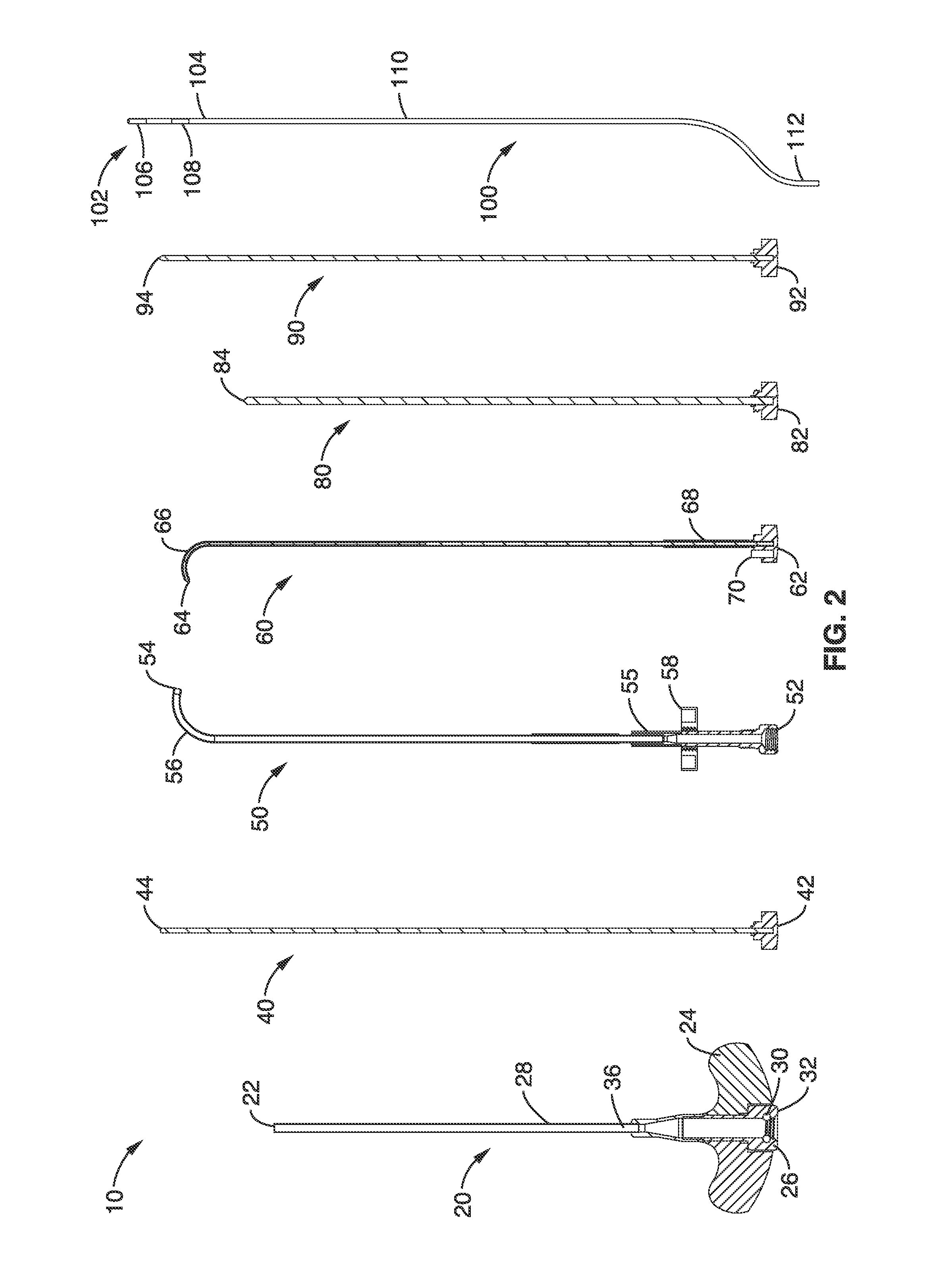 Basivertebral nerve denervation