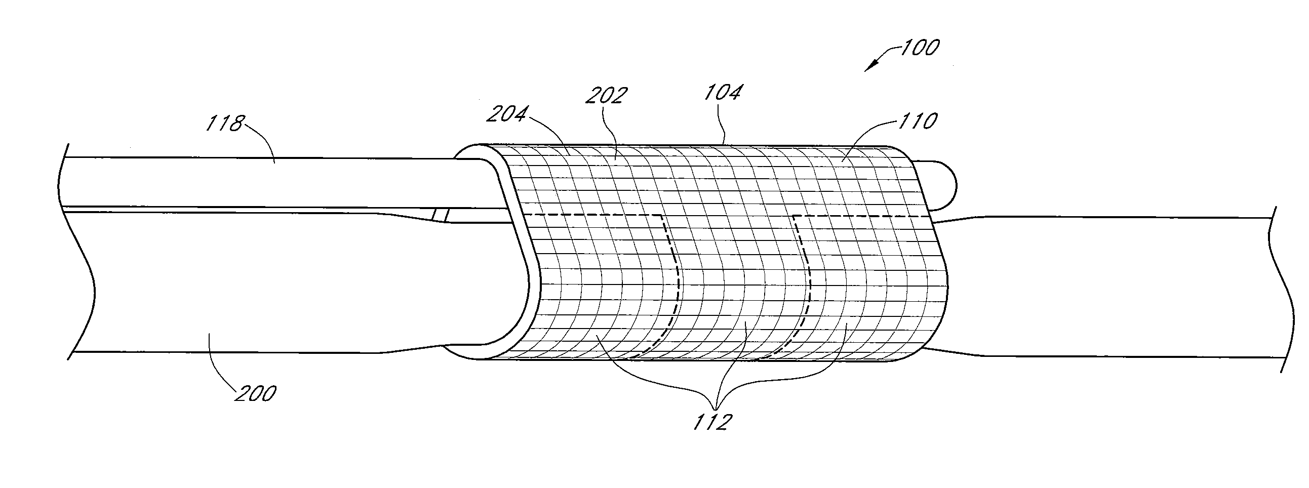 Shielded electrode assembly for effective nerve sensing and stimulation