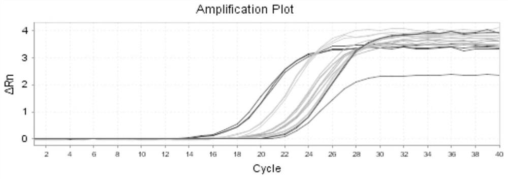 Q-PCR detection method for colorectal cancer marker DCD