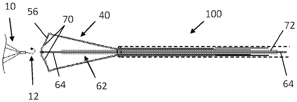 ivc filter recycling system with releasable capture feature