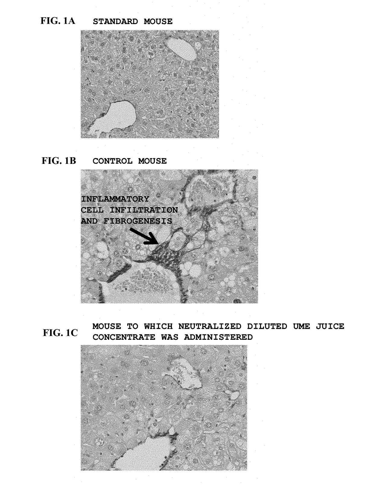 Prophylactic and/or therapeutic agent for nafld/nash