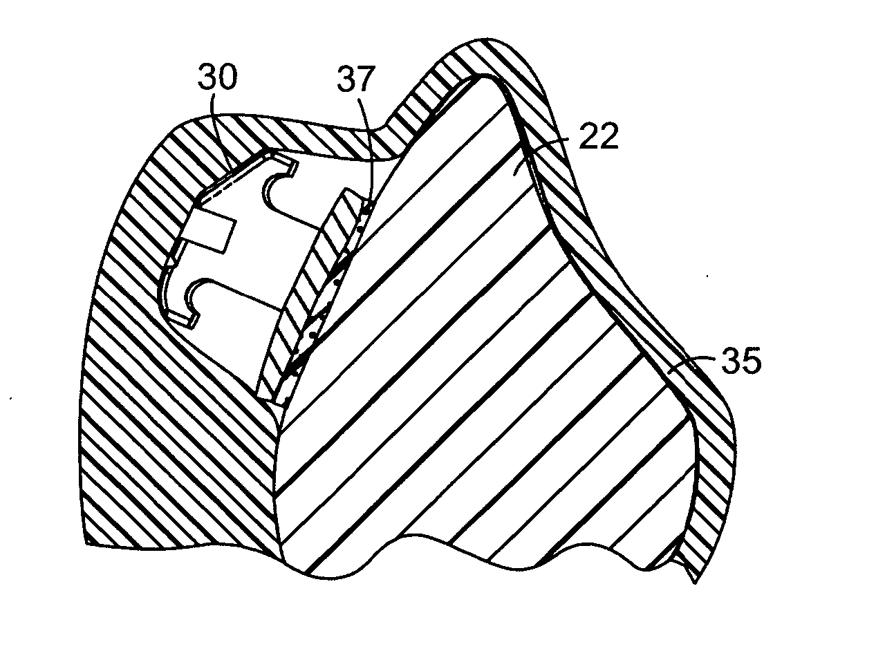 Method of making an indirect bonding tray for orthodontic treatment