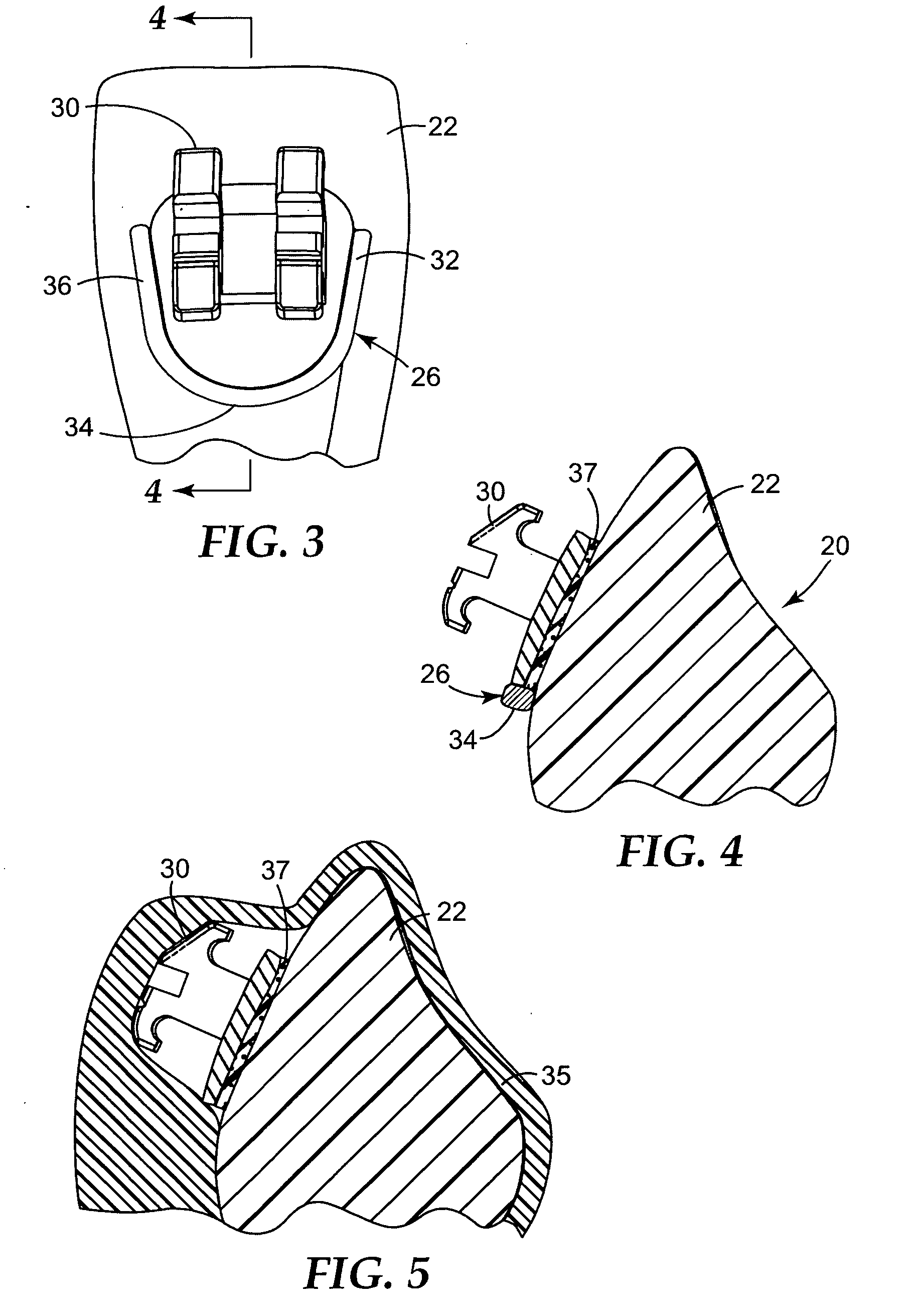 Method of making an indirect bonding tray for orthodontic treatment